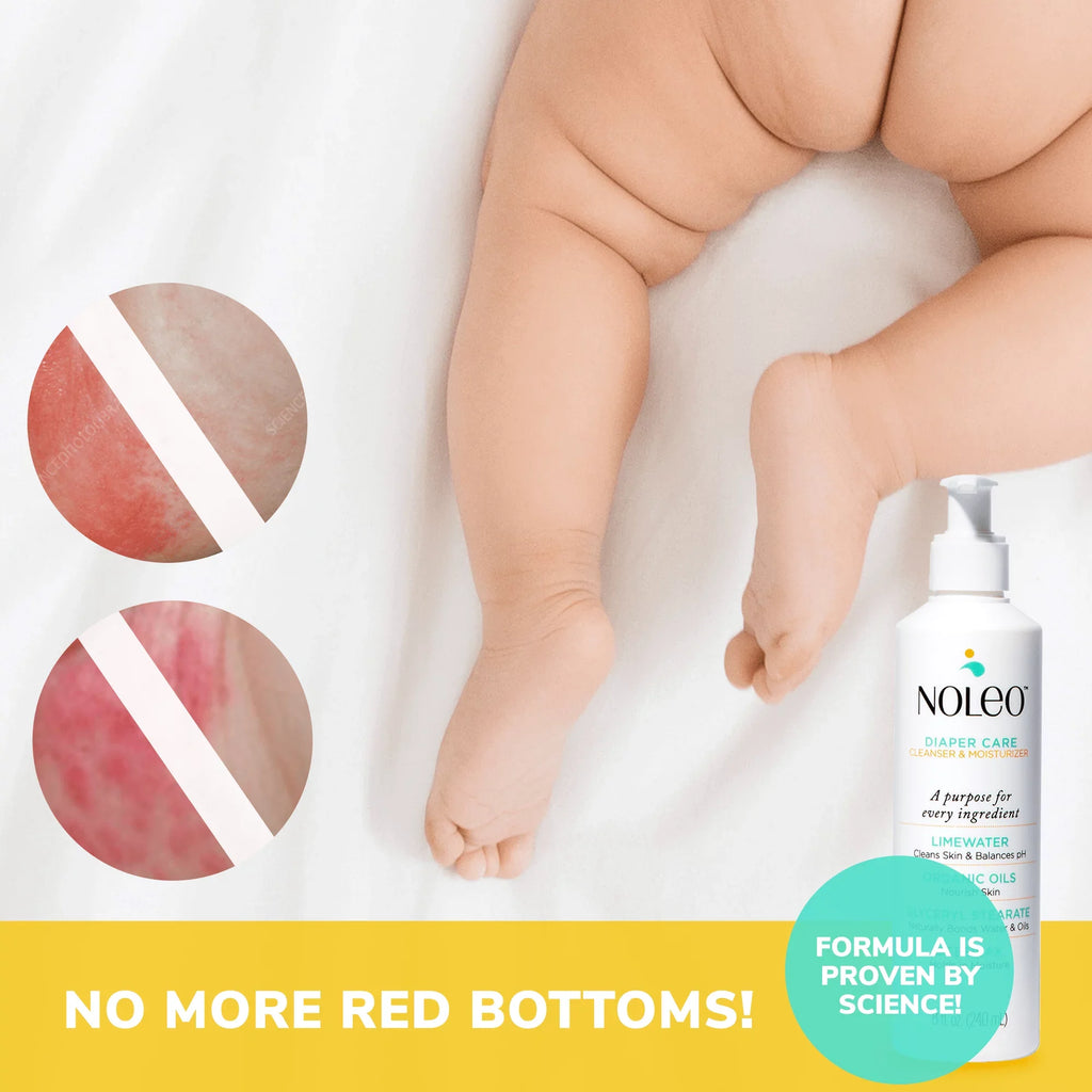 Diaper - Butt Treatment Rash for NOLEO Rash DUO
